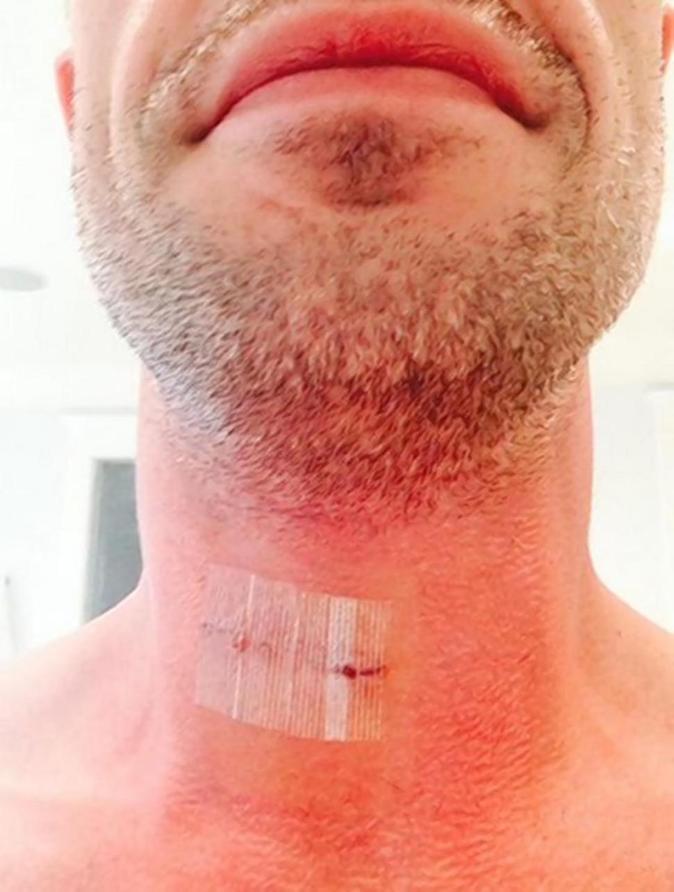 The ‘She’s All That’ did not reveal why he got his spinal surgery.