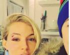 Alan Cummings posted a video to Instagram of himself and Sienna Miller after she had an injury during "Cabaret."